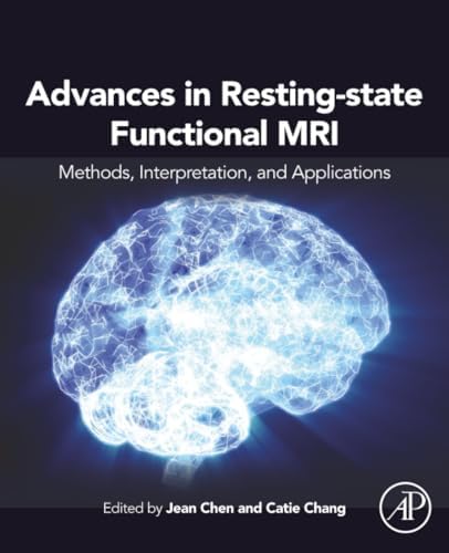 Computational and Network Modeling of Neuroimaging Data